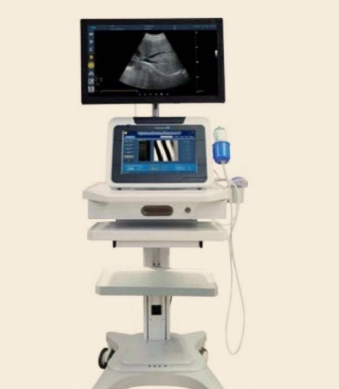 جهاز فيبروسكان FibroScan لمرونة الكبد